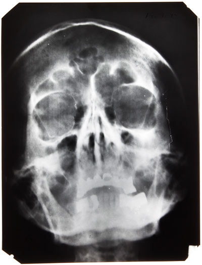 Vilkaisu Hitlerin pään sisään.