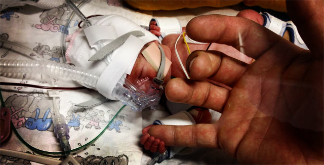 Pieni tyttö syntyi 21. maaliskuuta, 30. raskausviikon kohdalla.