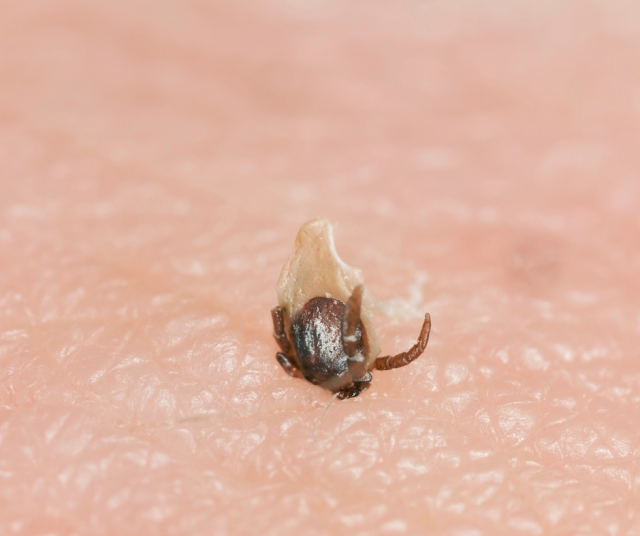 Poista punkki aina pihdeillä. Kuvituskuva.